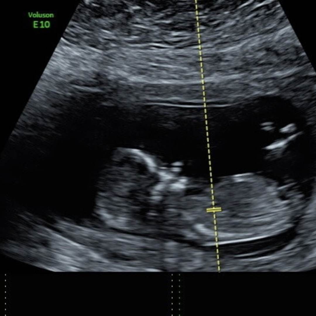 Photo shared by Dani for their Babylist baby registry.