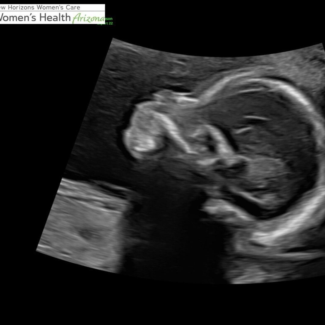 Photo shared by Hannah for their Babylist baby registry.