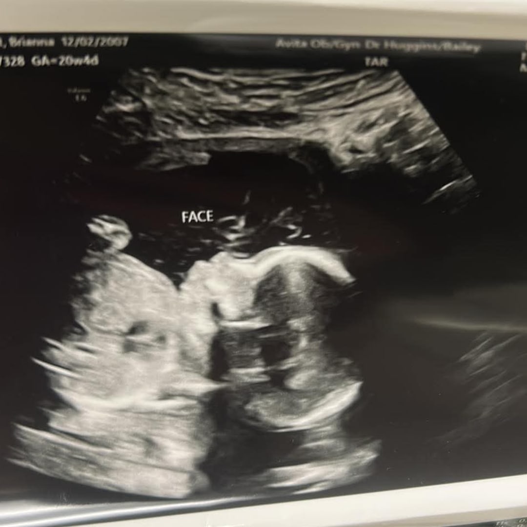 Photo shared by Brianna for their Babylist baby registry.