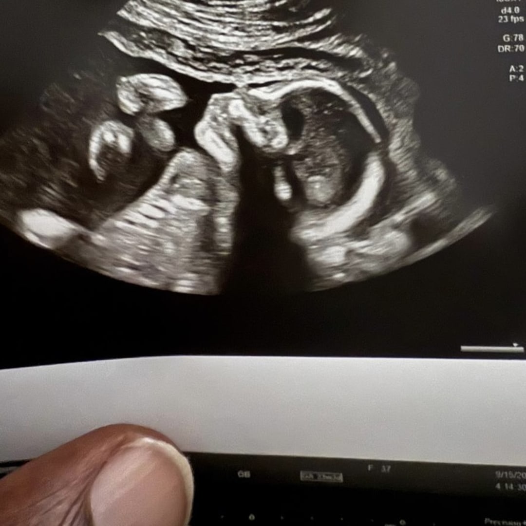 Photo shared by Shavonne for their Babylist baby registry.