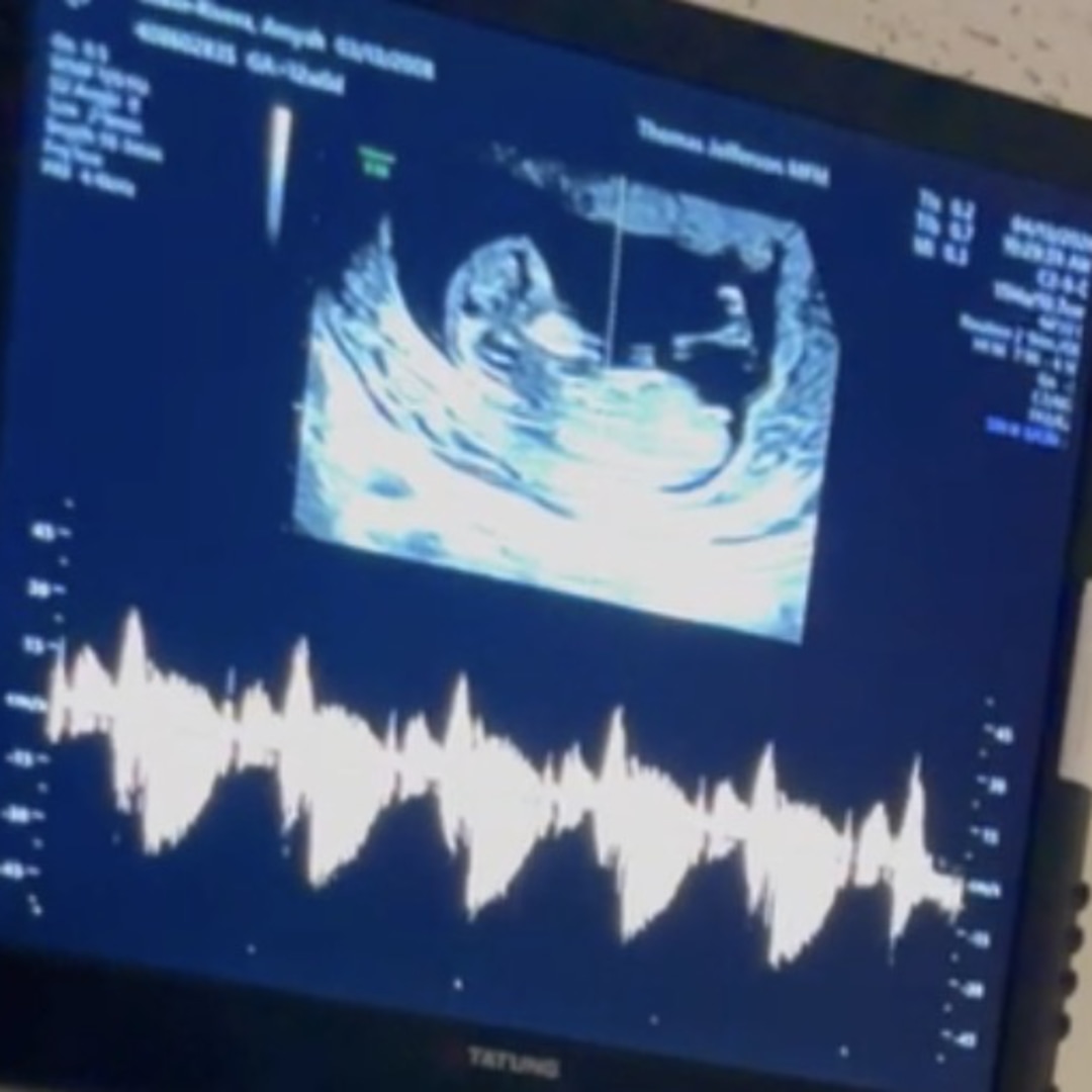 Photo shared by Amyah for their Babylist baby registry.