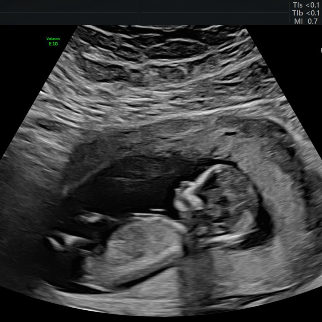 Photo shared by Jessica for their Babylist baby registry.