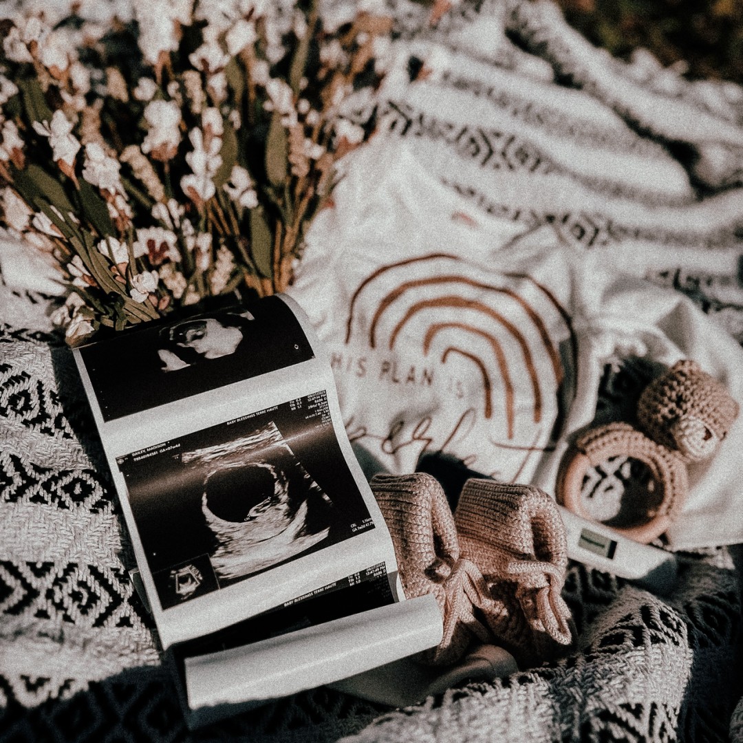 Photo shared by Madison for their Babylist baby registry.