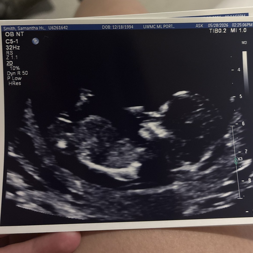 Photo shared by Samantha for their Babylist baby registry.