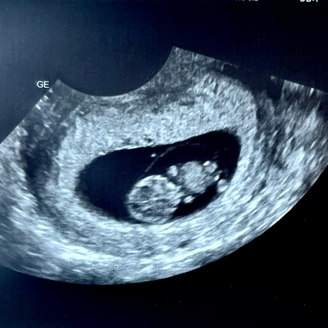 Photo shared by Amanda for their Babylist baby registry.