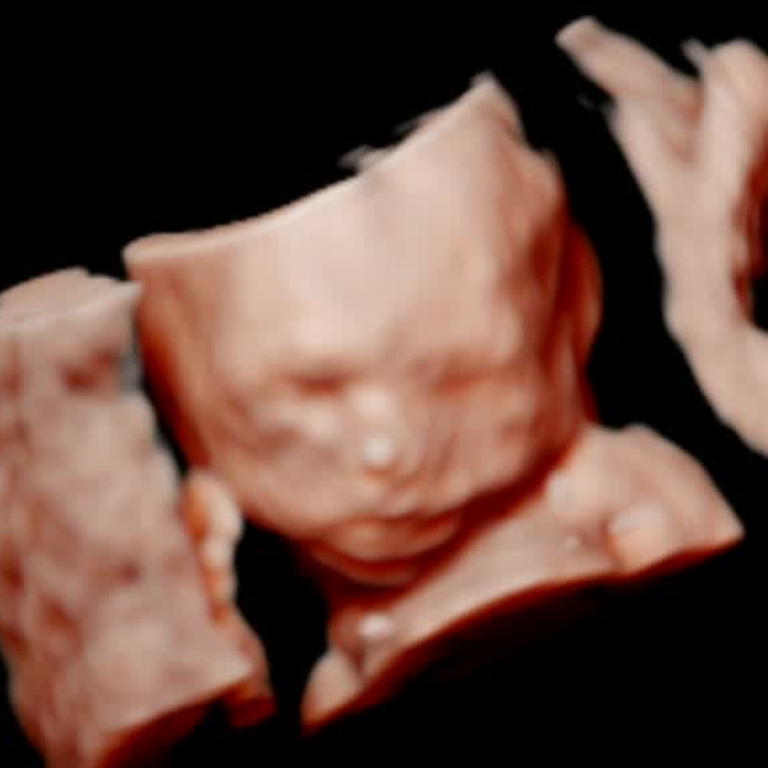 Photo shared by Lindsey for their Babylist baby registry.