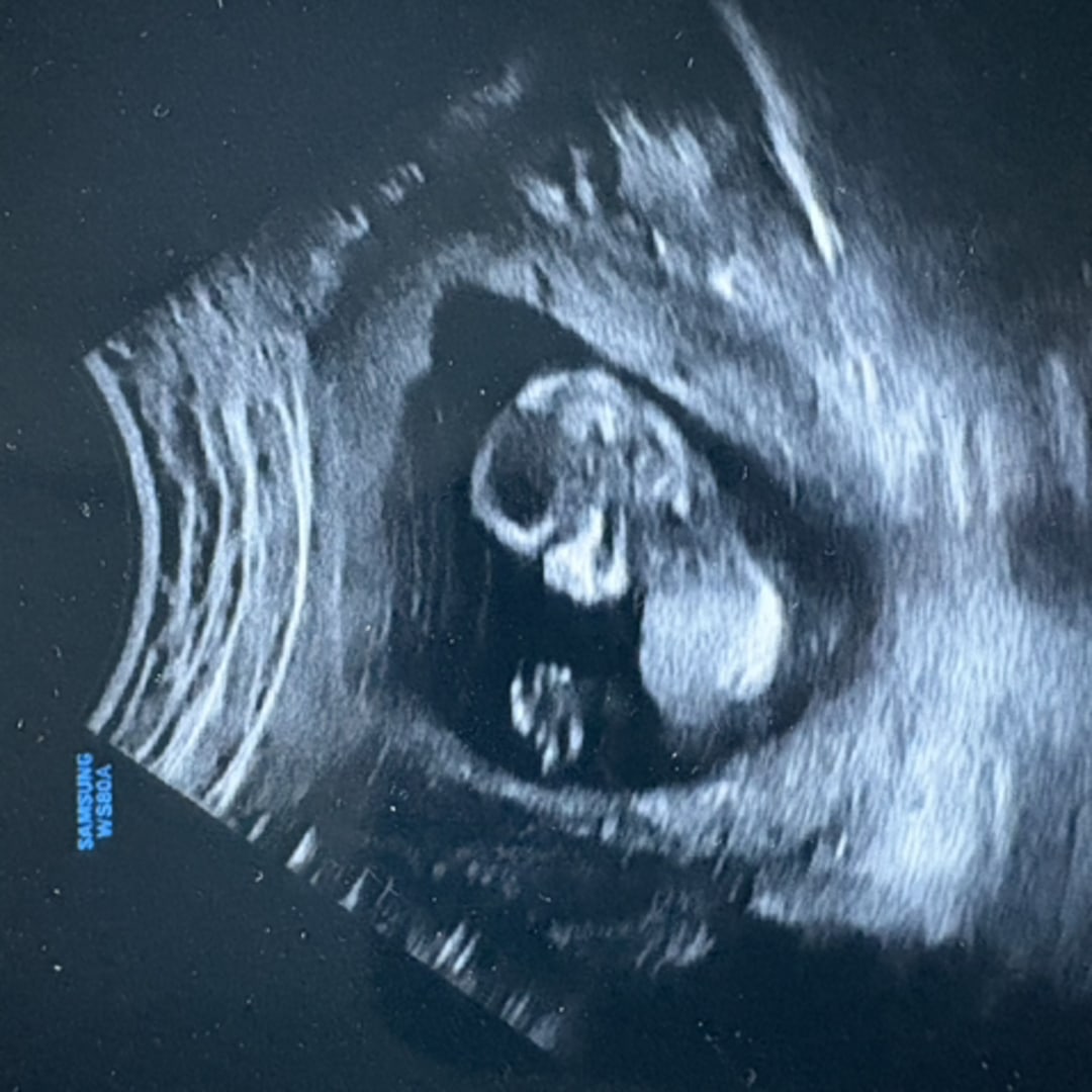 Photo shared by Genesis for their Babylist baby registry.