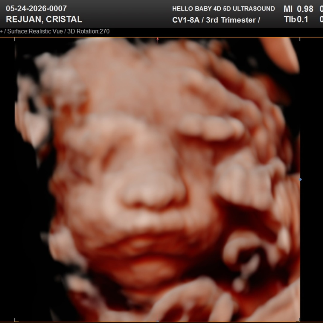 Photo shared by Cristal for their Babylist baby registry.