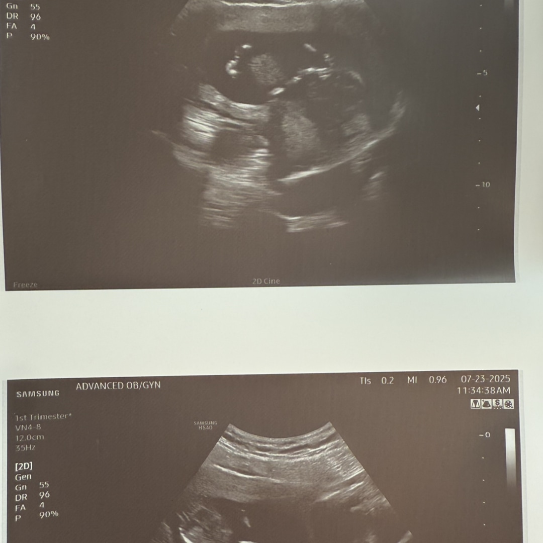 Photo shared by Brea for their Babylist baby registry.