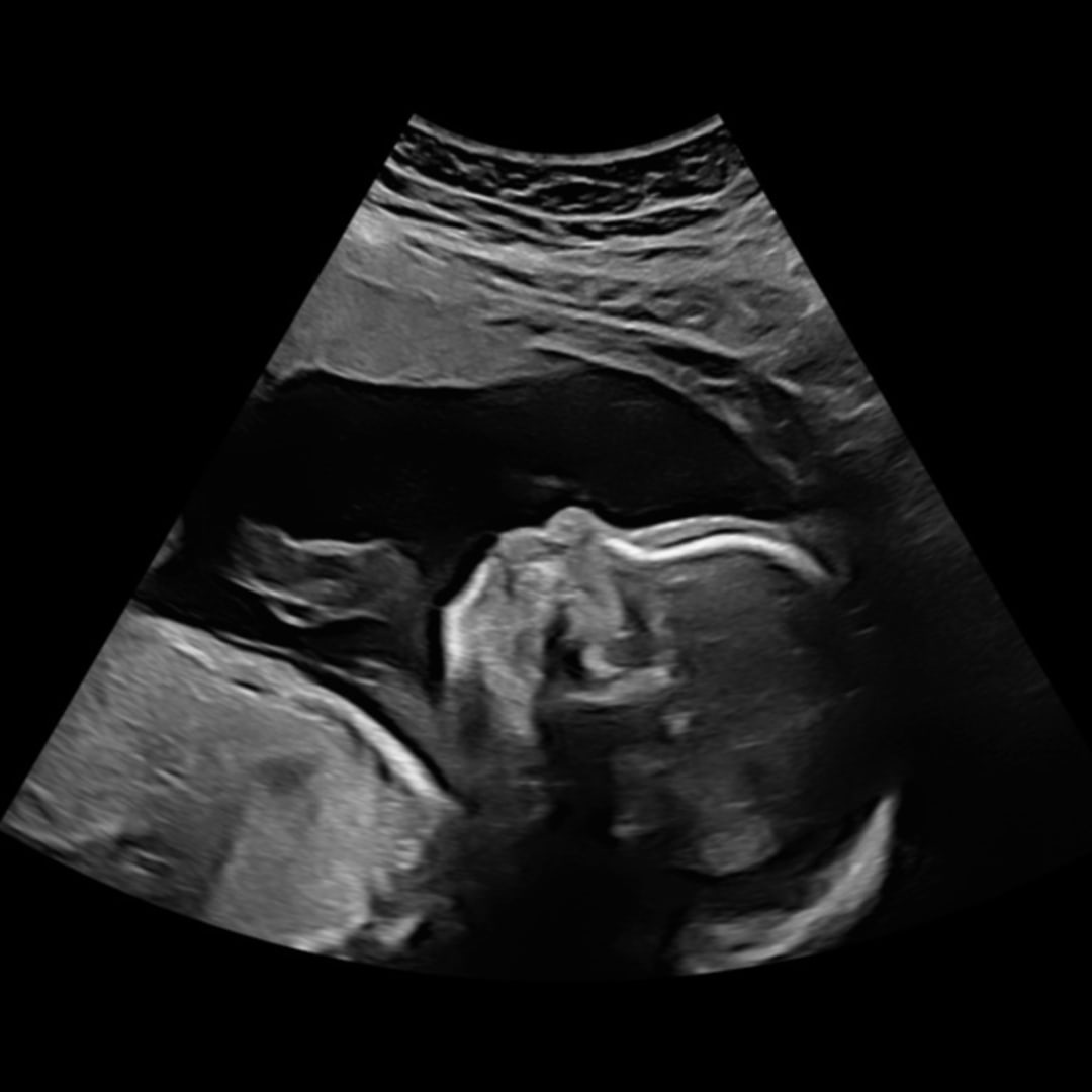 Photo shared by Rachael for their Babylist baby registry.