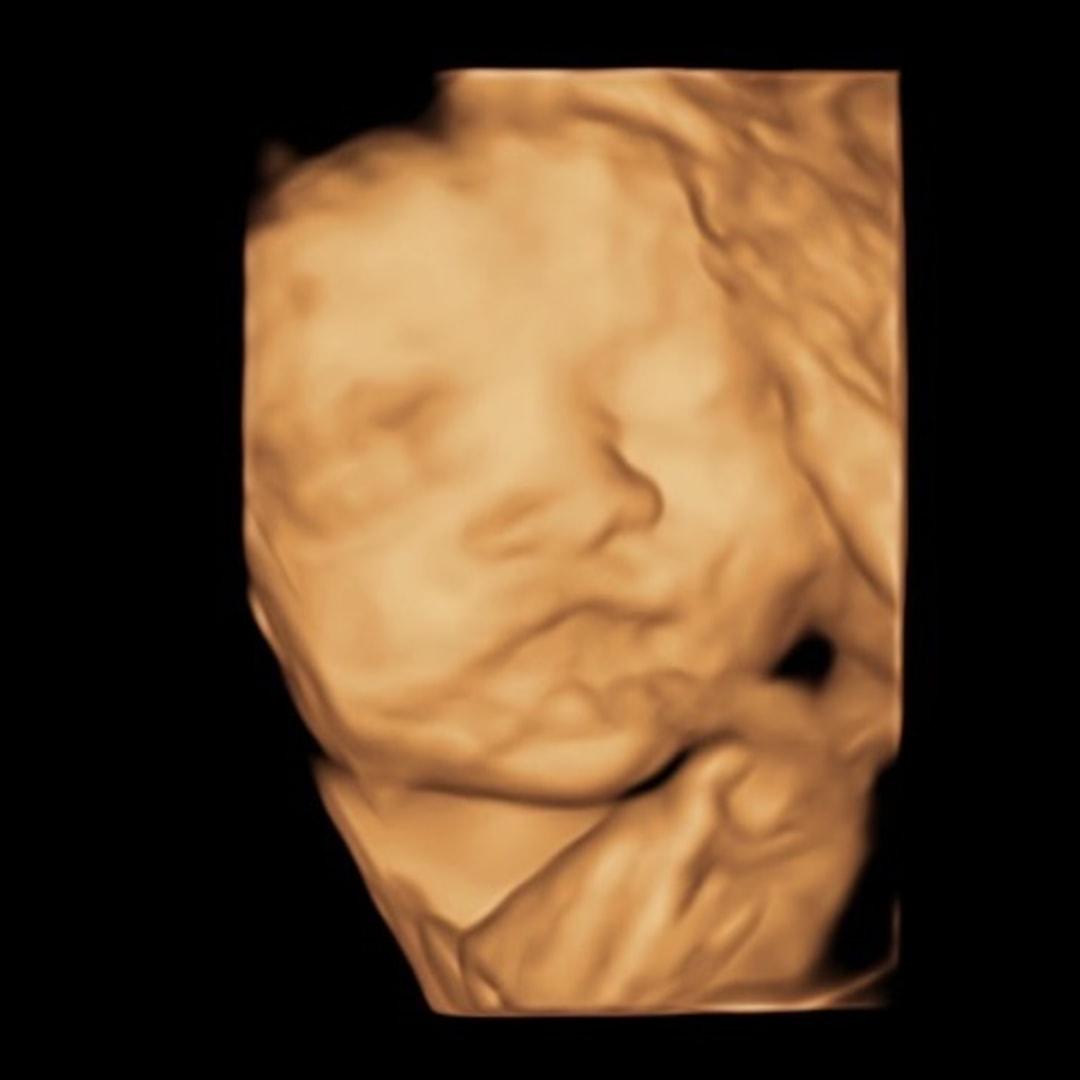 Photo shared by Gemma for their Babylist baby registry.