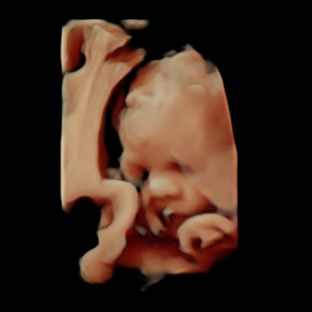 Photo shared by Mackenzie for their Babylist baby registry.