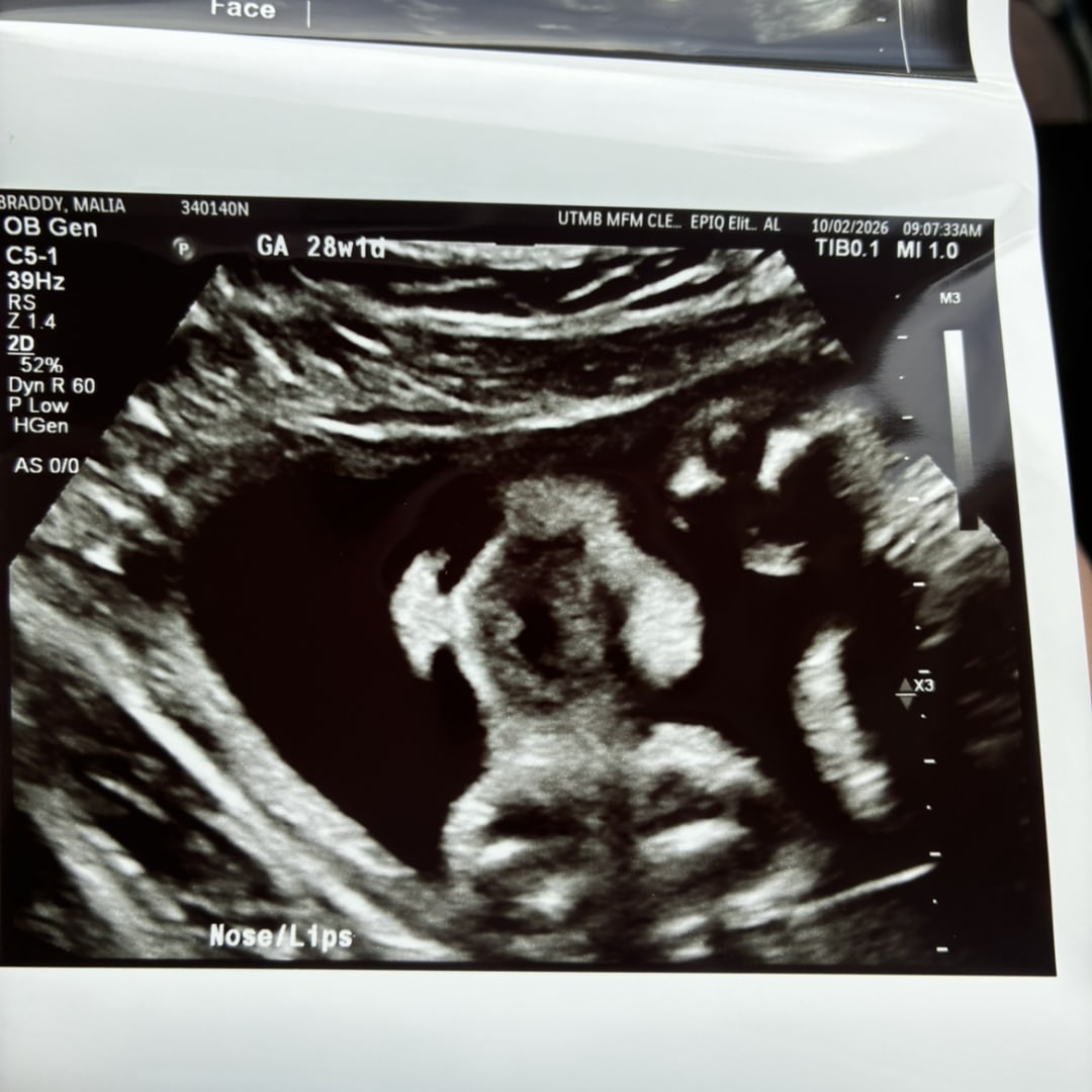 Photo shared by Malia B & for their Babylist baby registry.