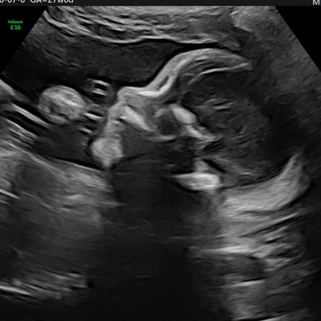 Photo shared by Cheyanne for their Babylist baby registry.