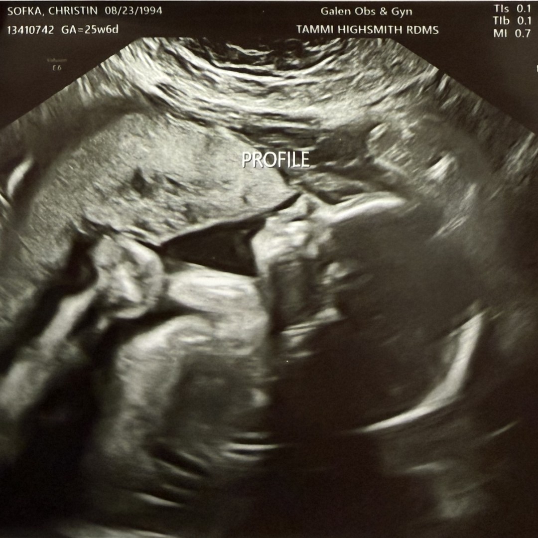 Photo shared by Christin for their Babylist baby registry.