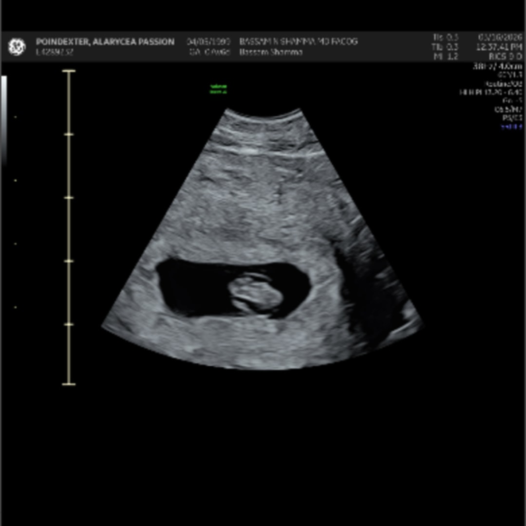 Photo shared by Alaraycea for their Babylist baby registry.