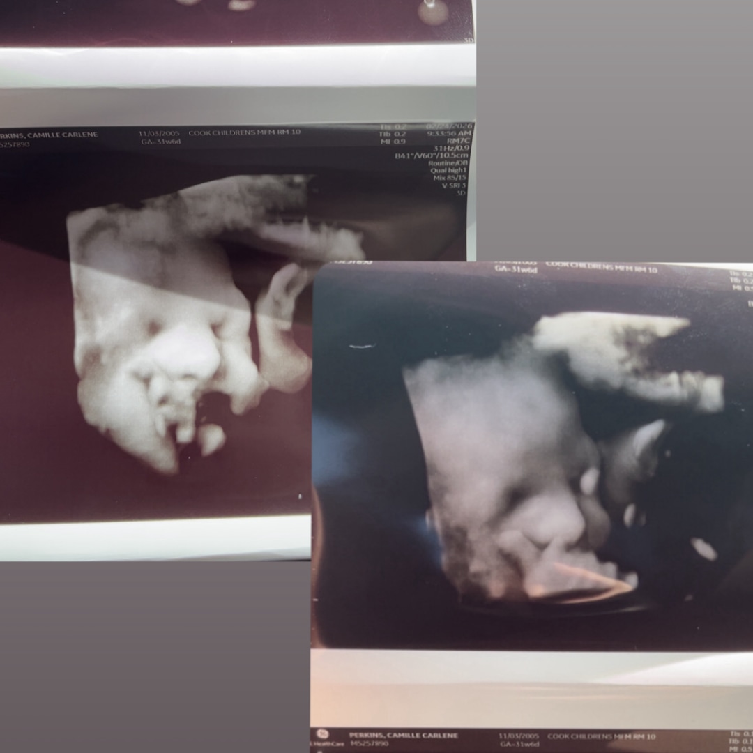 Photo shared by Camille for their Babylist baby registry.