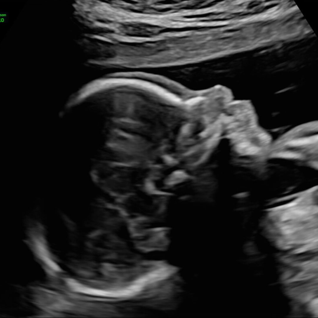 Photo shared by Kimmy for their Babylist baby registry.