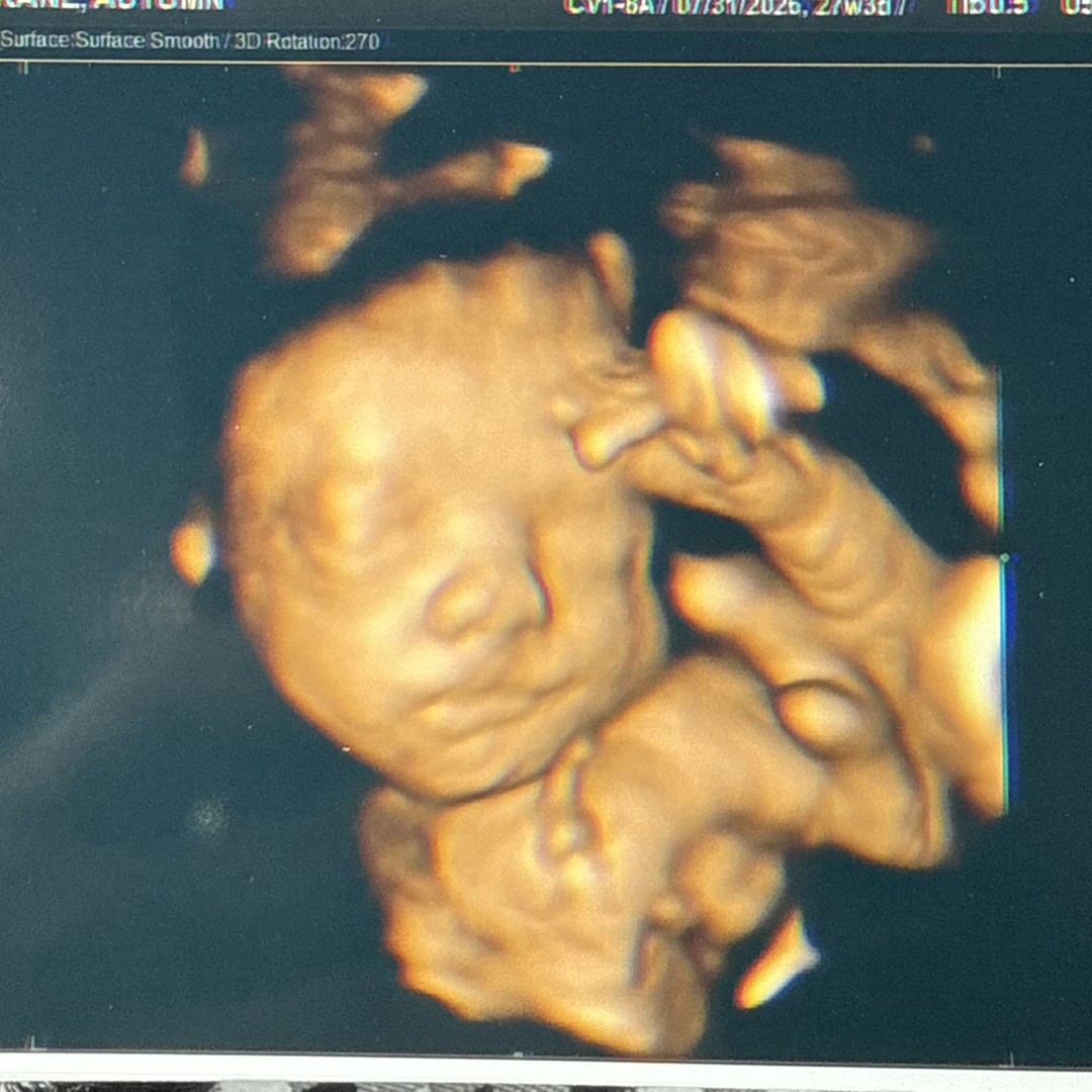Photo shared by Autumn for their Babylist baby registry.