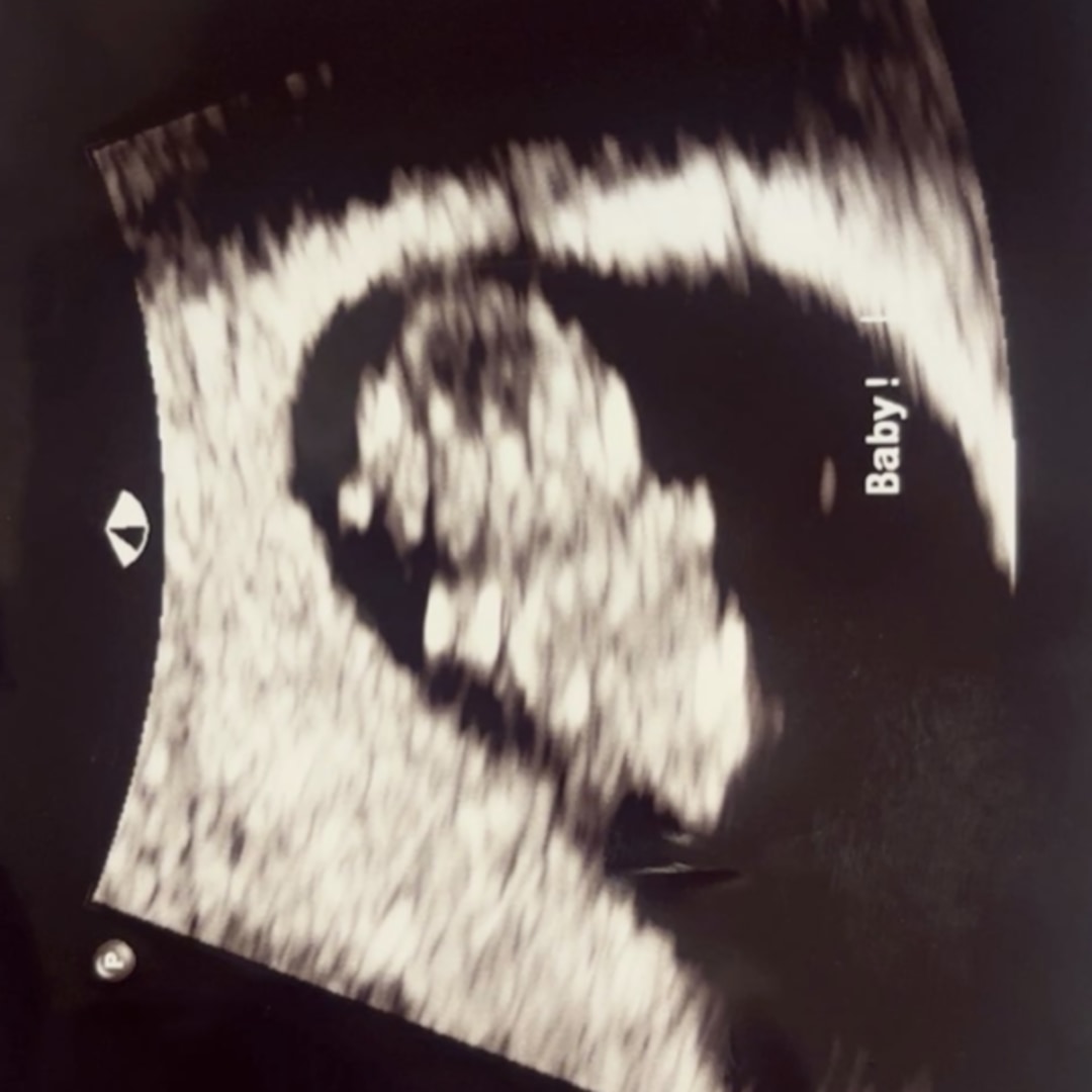 Photo shared by Janasia for their Babylist baby registry.