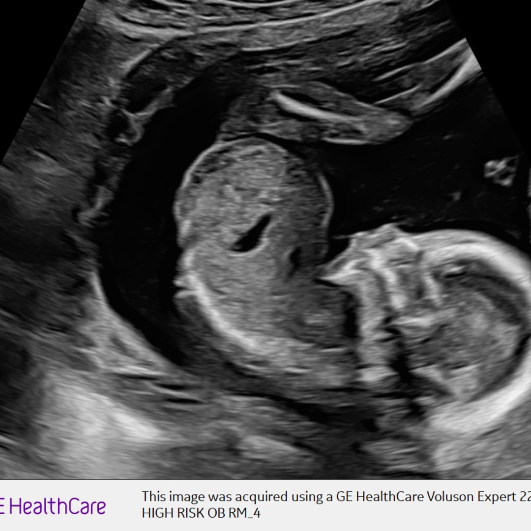 Photo shared by Anna for their Babylist baby registry.