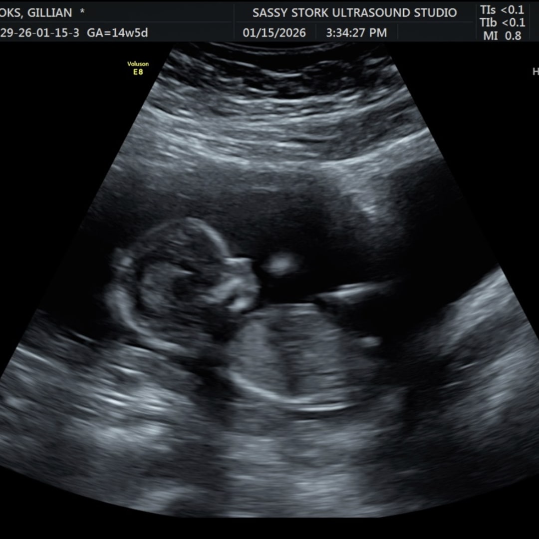 Photo shared by Gillian for their Babylist baby registry.