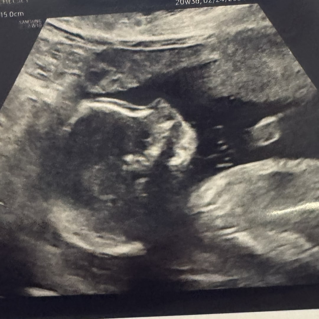 Photo shared by Chelsey for their Babylist baby registry.