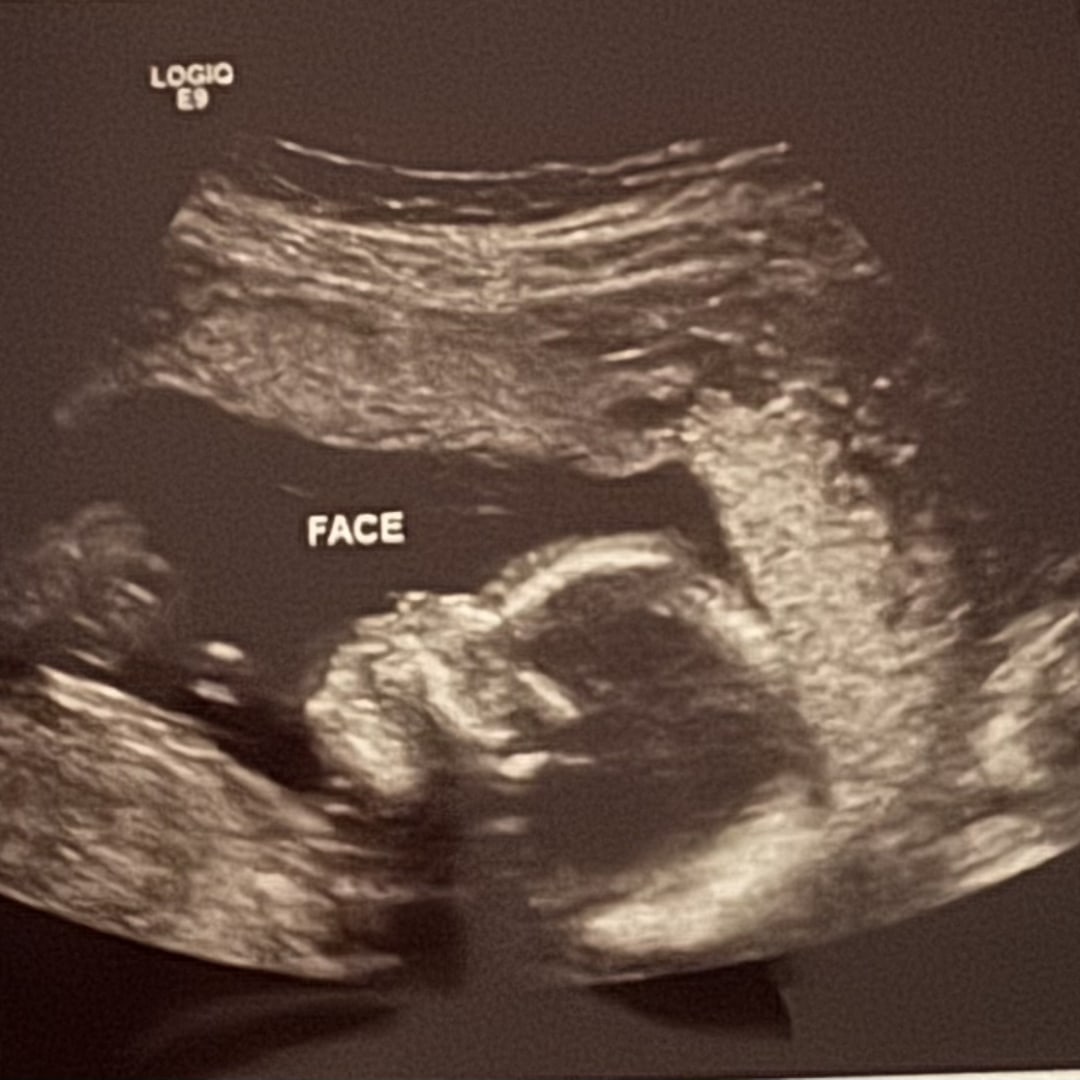 Photo shared by Haley for their Babylist baby registry.