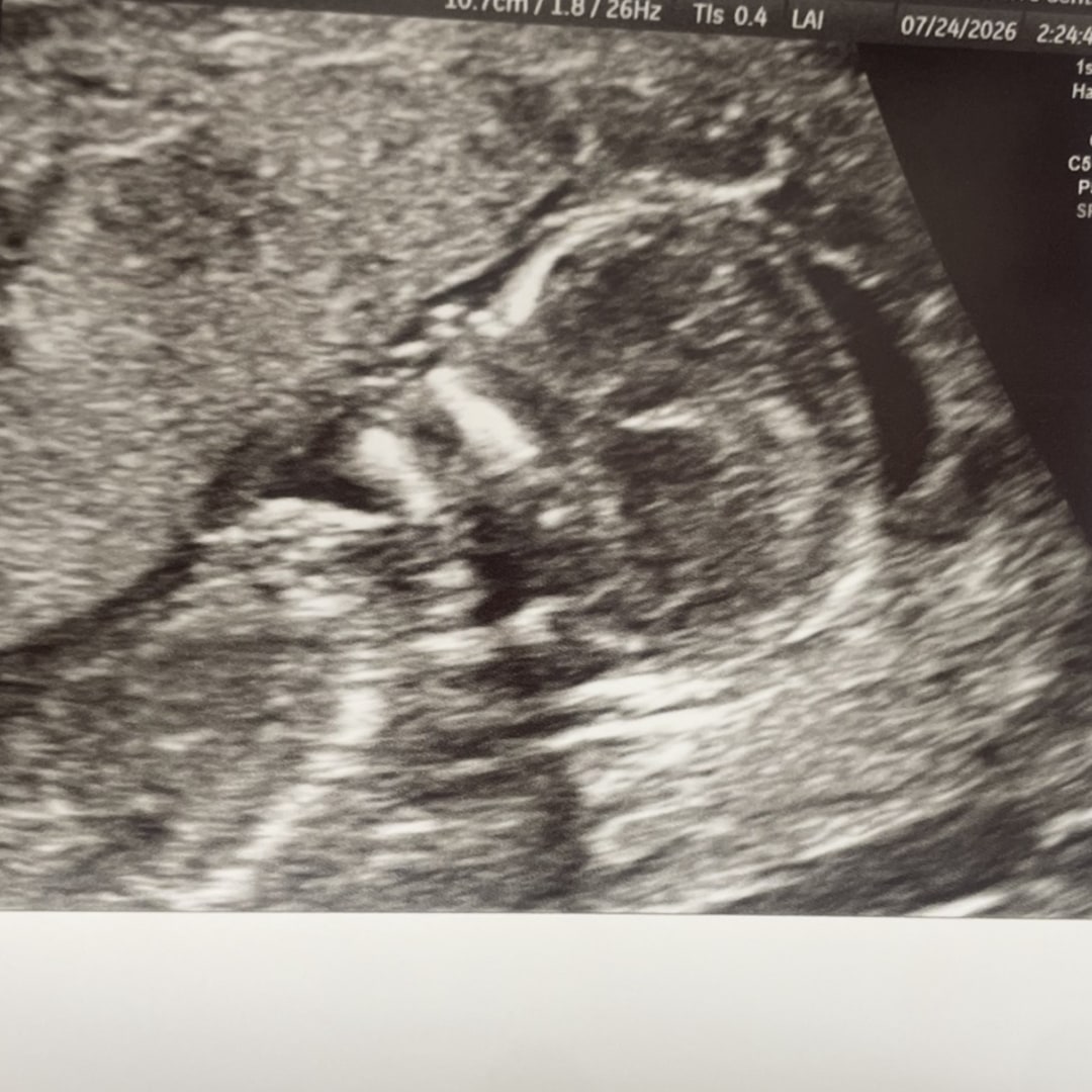 Photo shared by Julia for their Babylist baby registry.