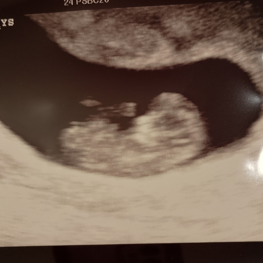 Photo shared by Selah for their Babylist baby registry.