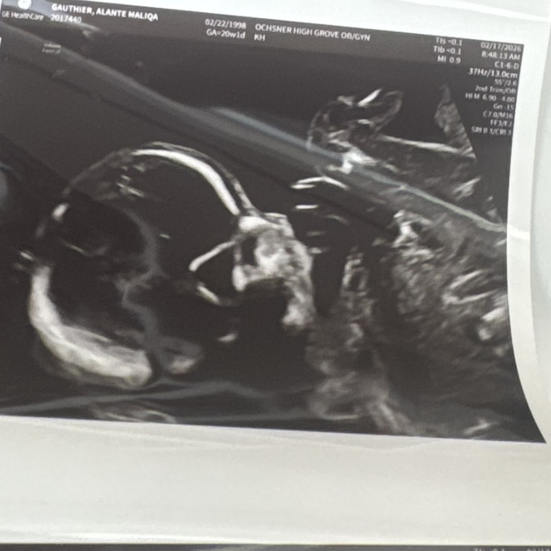 Photo shared by Alante for their Babylist baby registry.