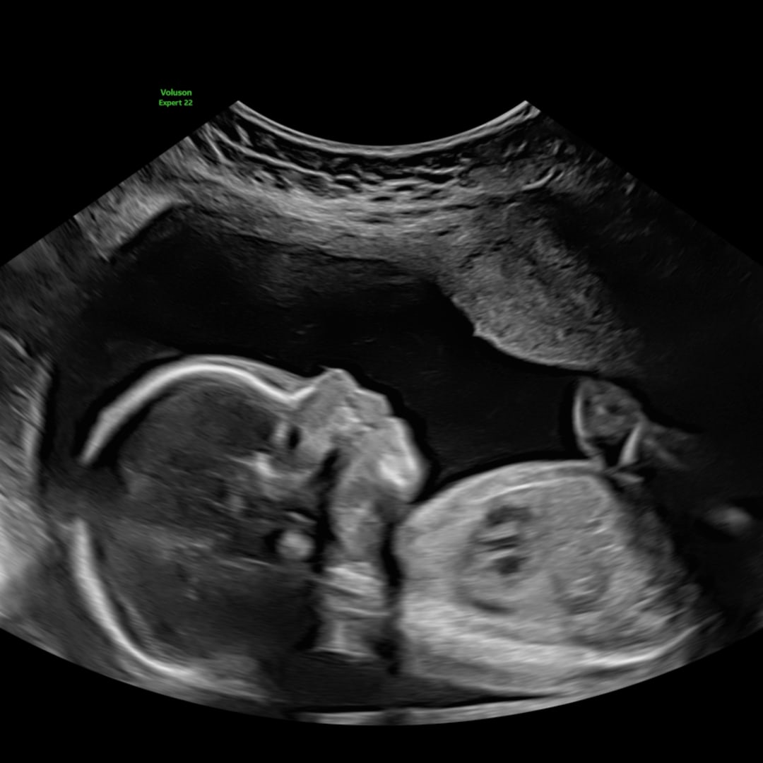 Photo shared by Aaliyha for their Babylist baby registry.