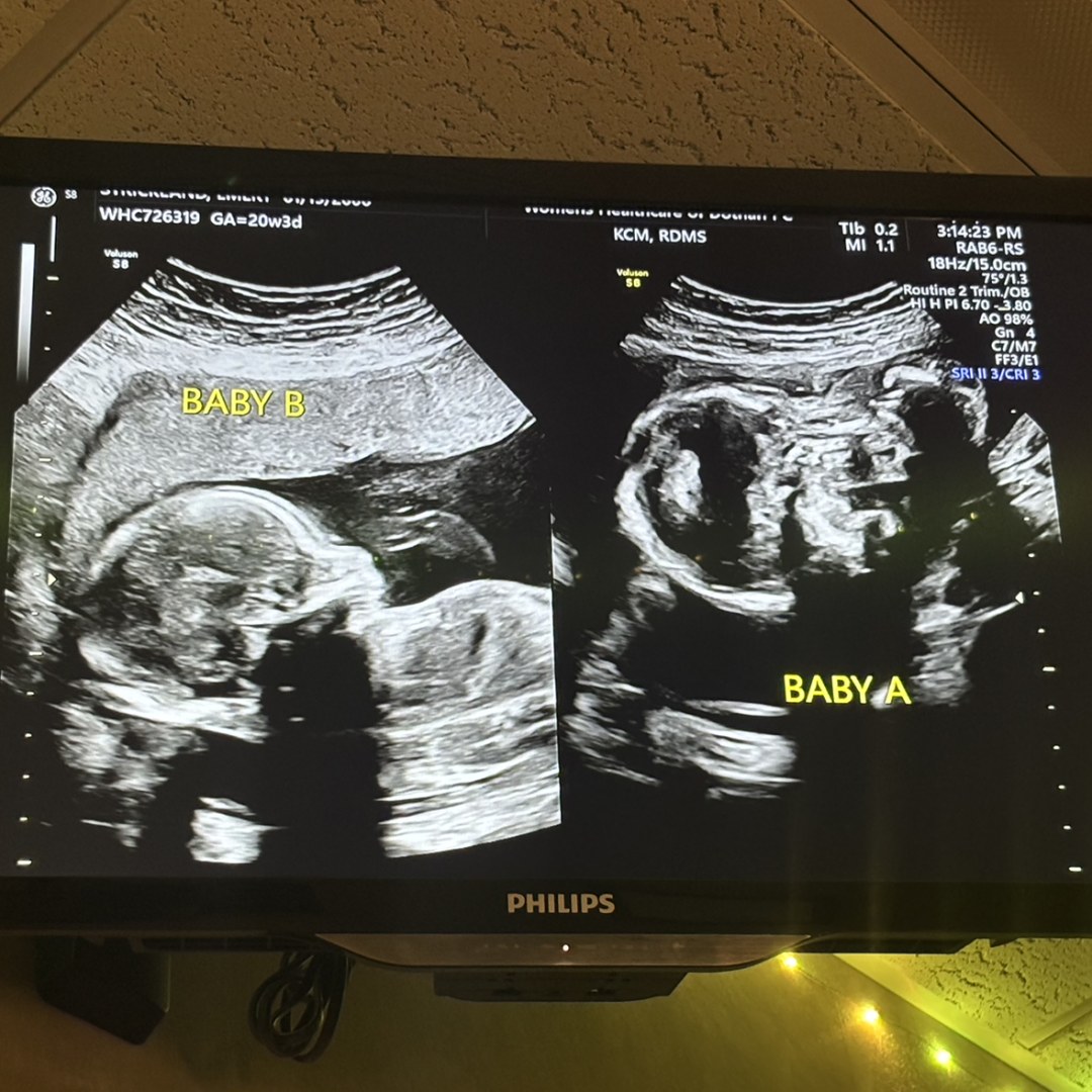 Photo shared by Emery for their Babylist baby registry.
