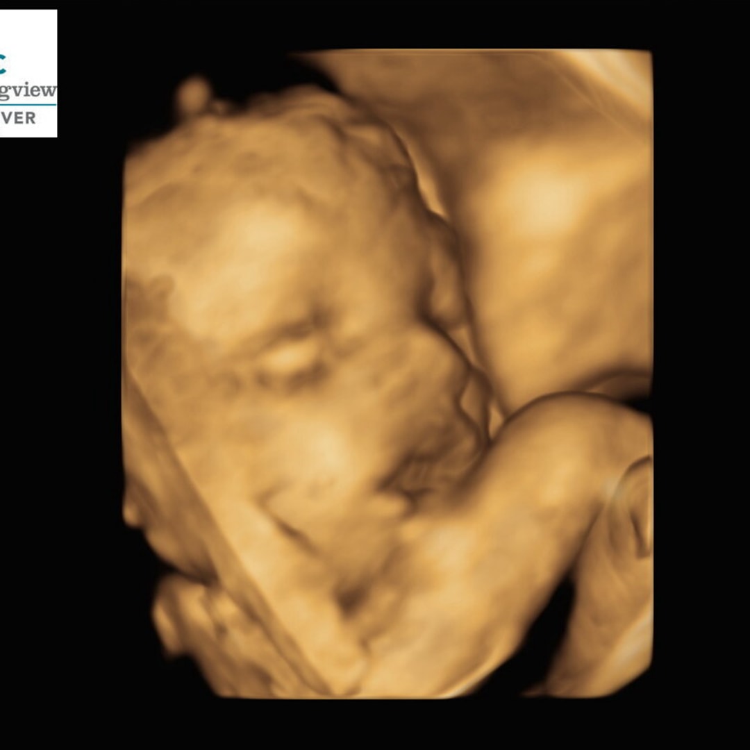 Photo shared by Grace for their Babylist baby registry.