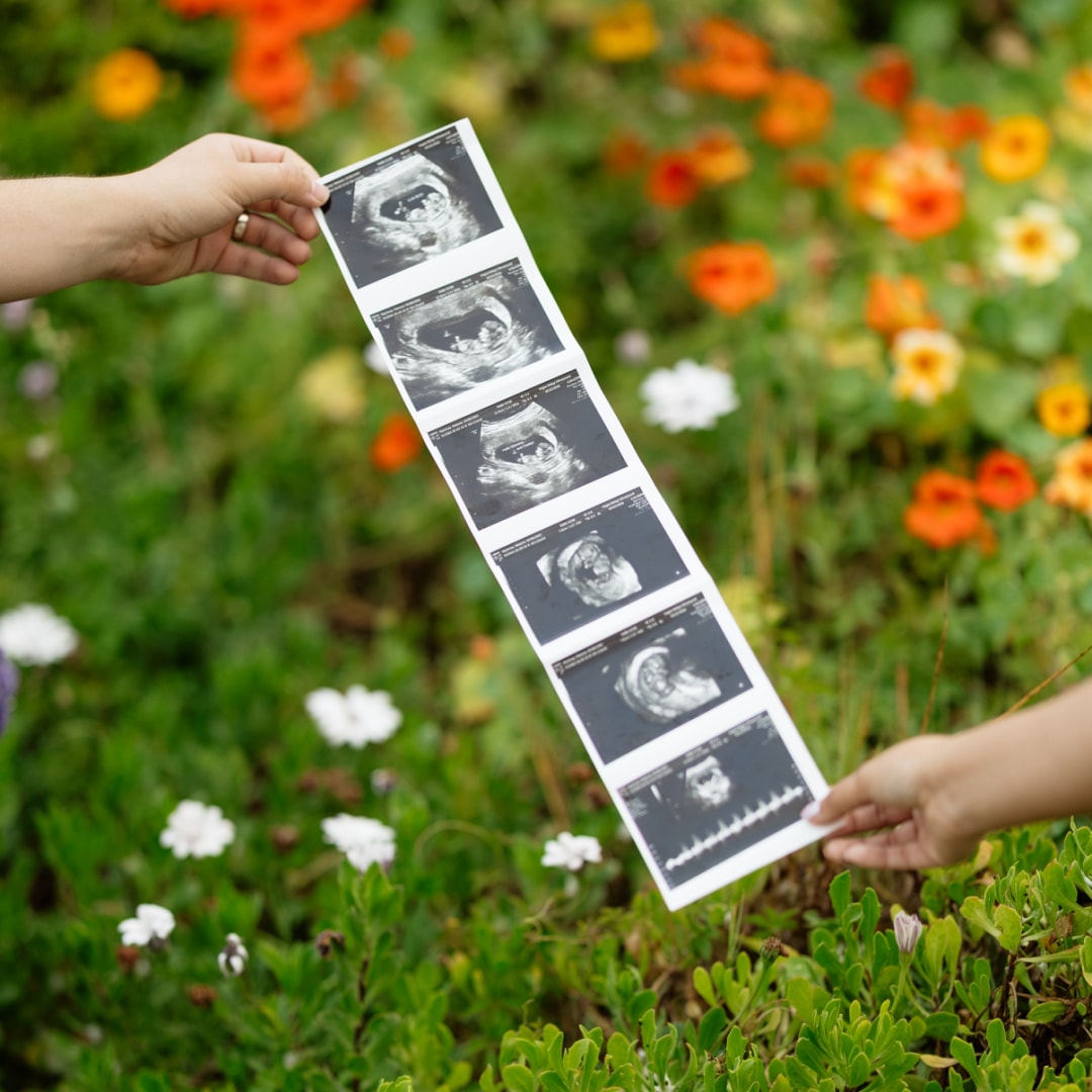 Photo shared by Mel for their Babylist baby registry.