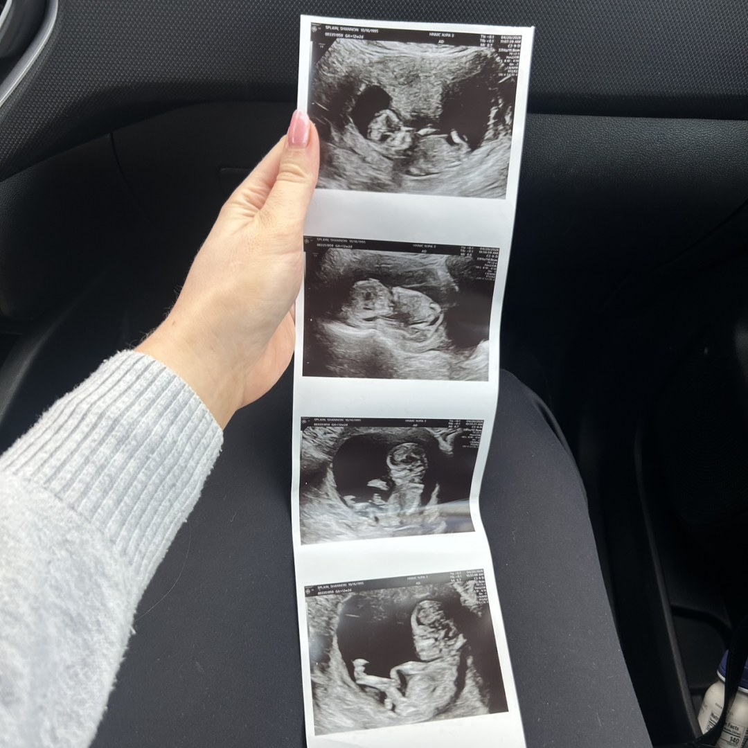 Photo shared by Shannon for their Babylist baby registry.