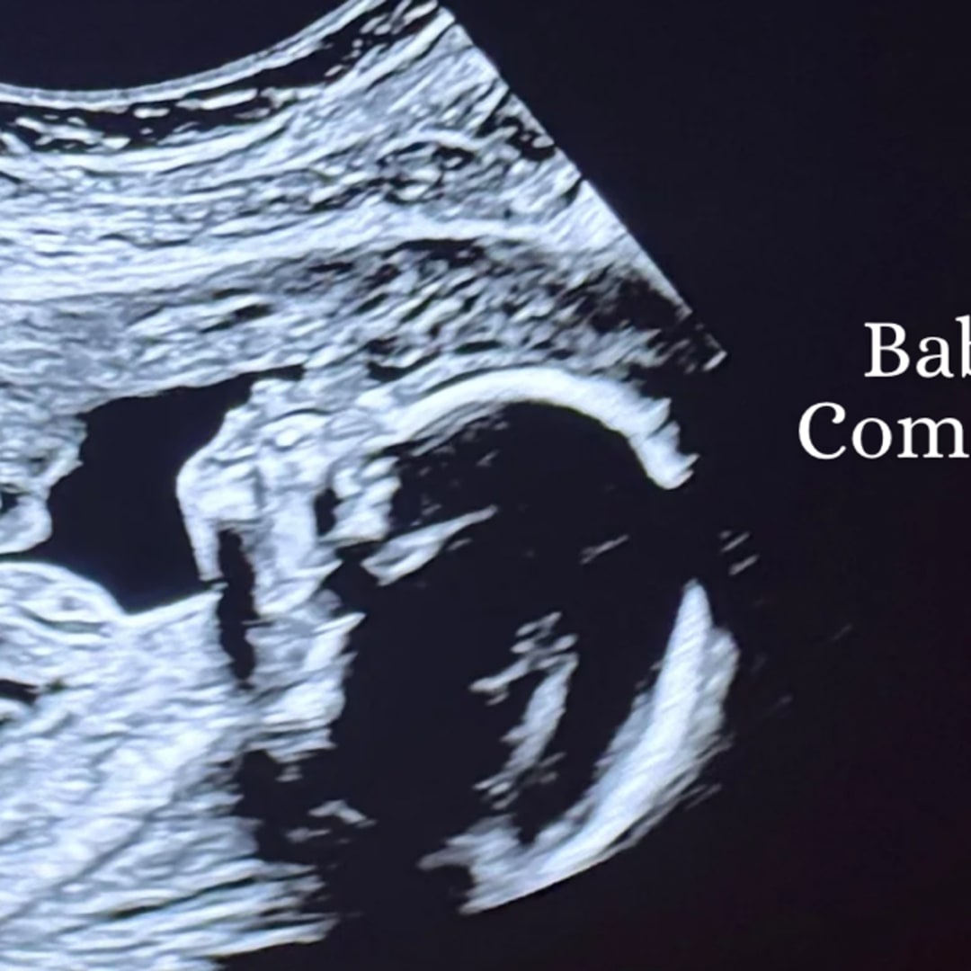 Photo shared by Anya for their Babylist baby registry.