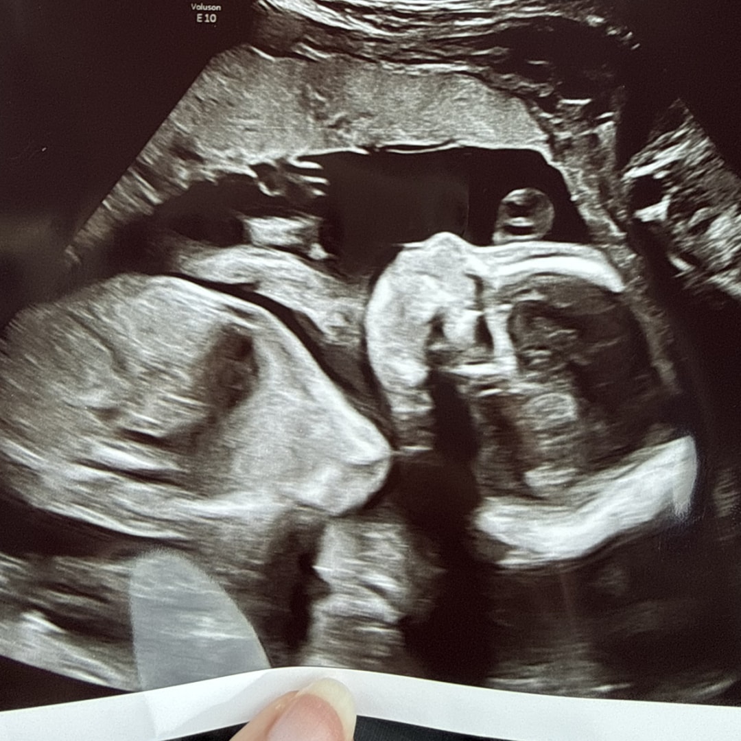 Photo shared by Abigail for their Babylist baby registry.