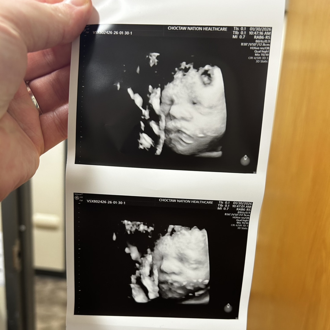 Photo shared by Mikayla for their Babylist baby registry.