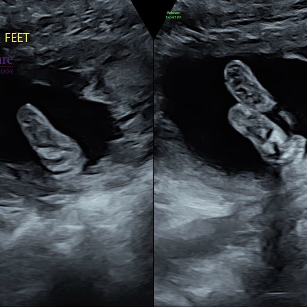 Photo shared by Chelsea for their Babylist baby registry.