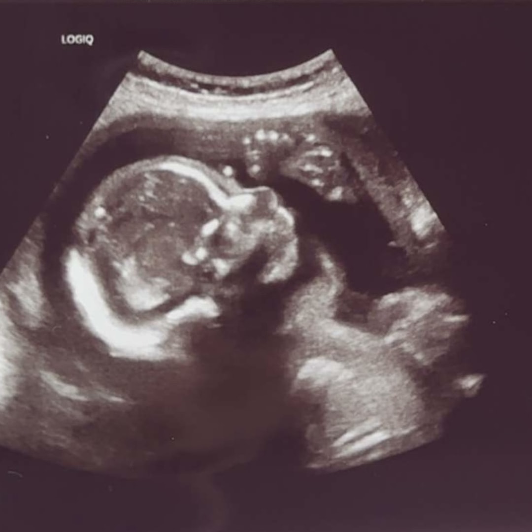 Photo shared by Amber for their Babylist baby registry.