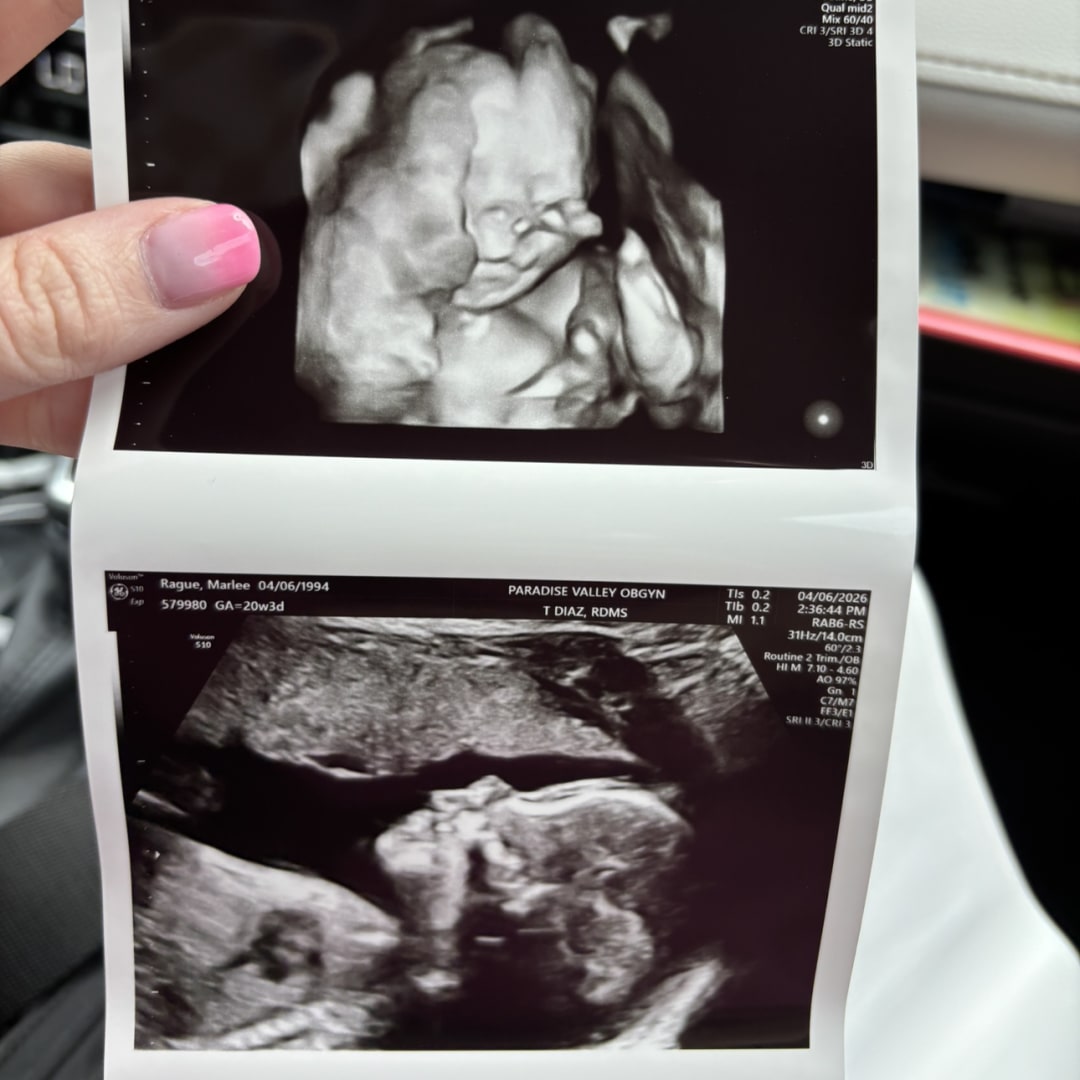 Photo shared by Marlee for their Babylist baby registry.