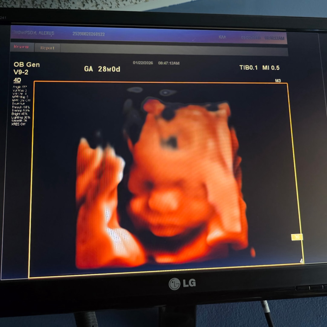 Photo shared by Alexus for their Babylist baby registry.