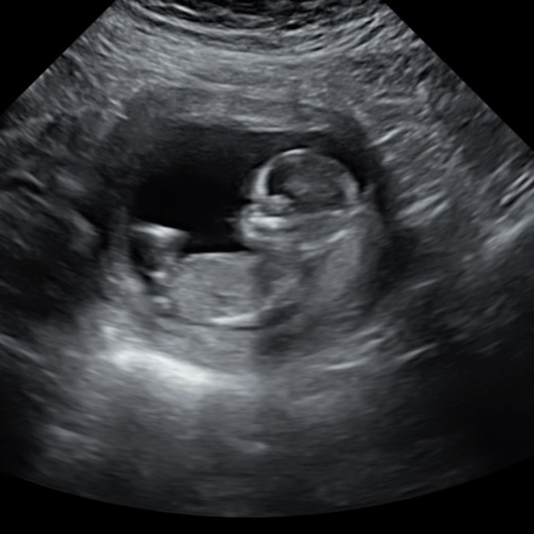 Photo shared by Kathryn for their Babylist baby registry.