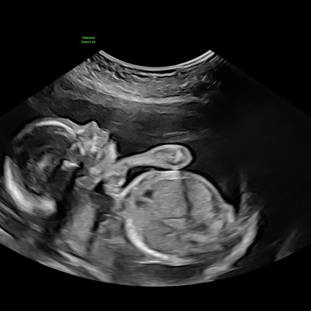 Photo shared by Anna for their Babylist baby registry.