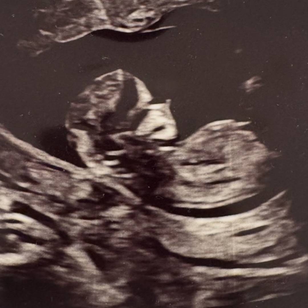 Photo shared by Melissa for their Babylist baby registry.
