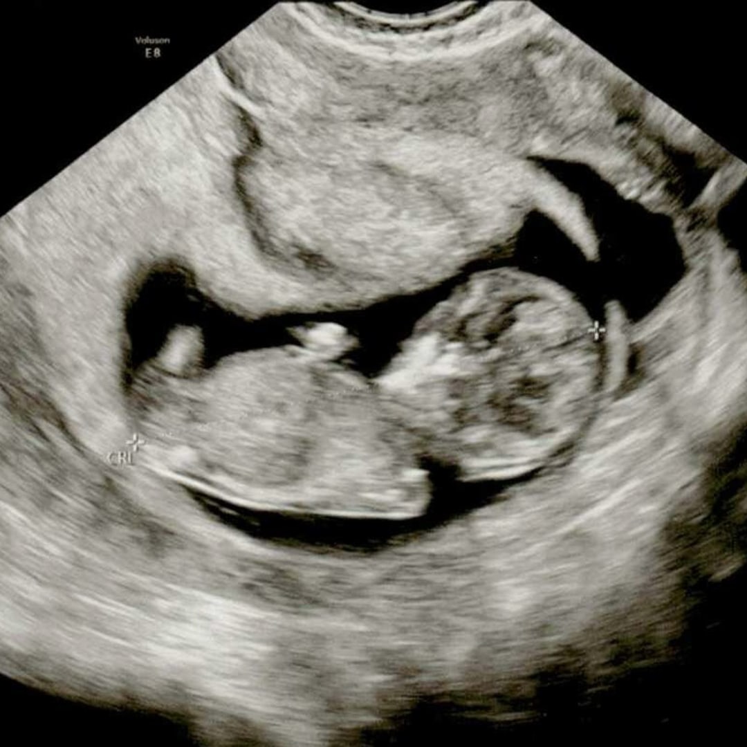 Photo shared by Maribel & Ramon for their Babylist baby registry.