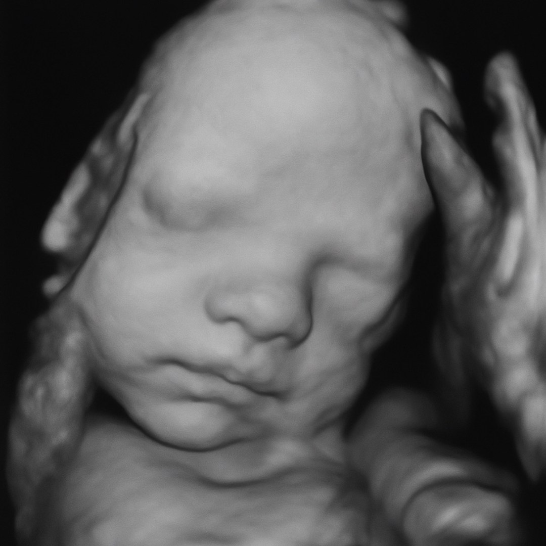Photo shared by Elizabeth for their Babylist baby registry.