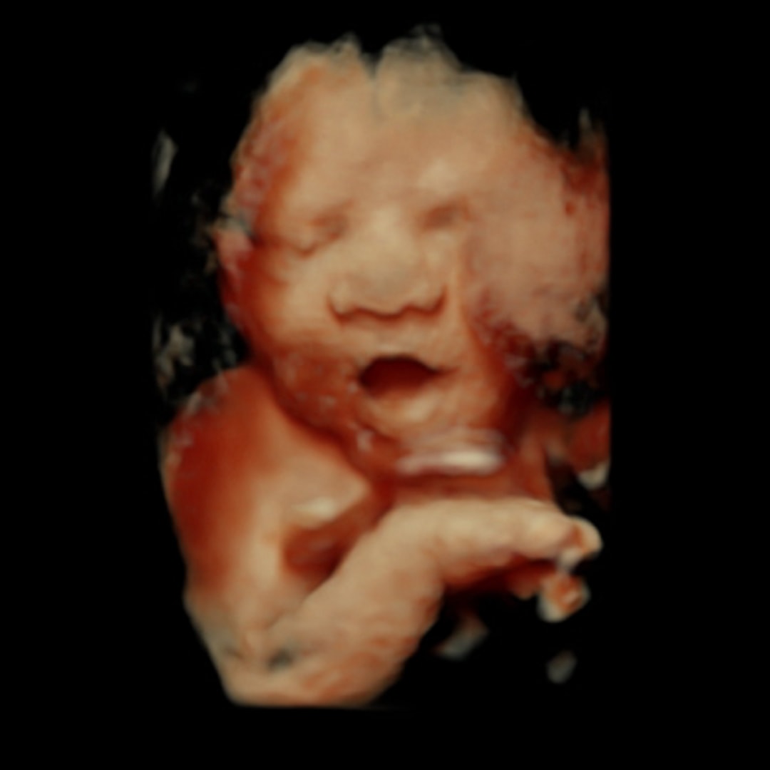 Photo shared by Bianca for their Babylist baby registry.