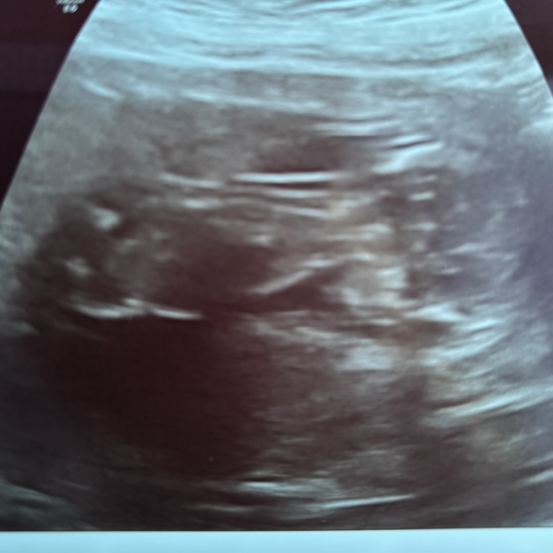 Photo shared by Samantha for their Babylist baby registry.